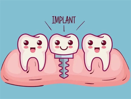 種植牙漫畫示意圖
