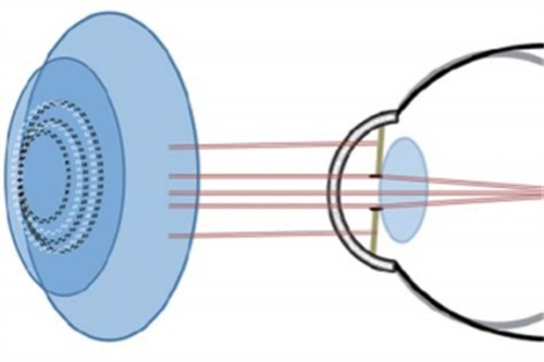 2024年尼康控優(yōu)點鏡片價格表：2280元+，將1.0-3.0系列詳細收費這里看！