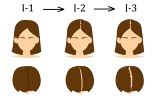 輕度脫發(fā)素材