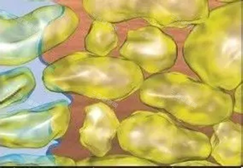 水動力吸脂微觀示意圖