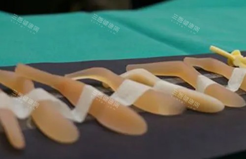硅膠隆鼻假體照片