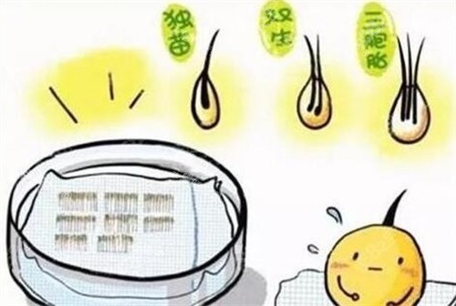 hbw毛囊克隆操作過程圖解