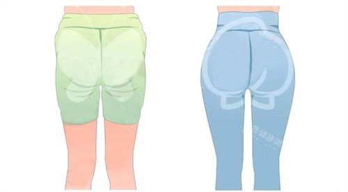 臀部吸脂手術(shù)背面對(duì)比動(dòng)畫(huà)圖