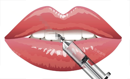 玻尿酸注射嘴巴動(dòng)畫(huà)展示