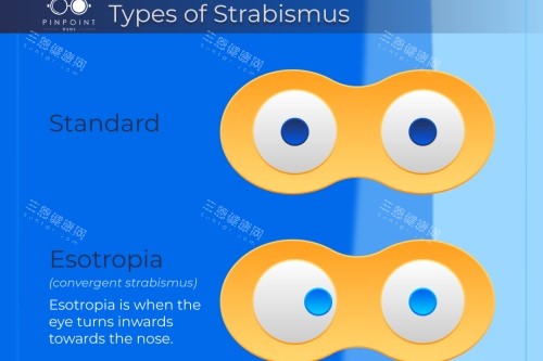 正常眼對比斜視眼