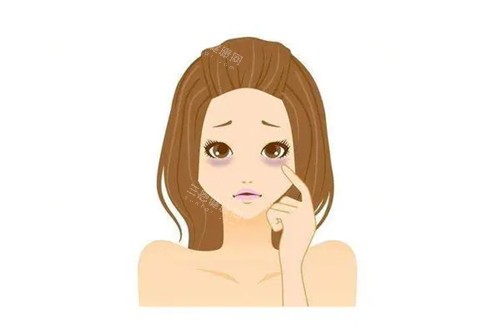 黑眼圈卡通示意圖