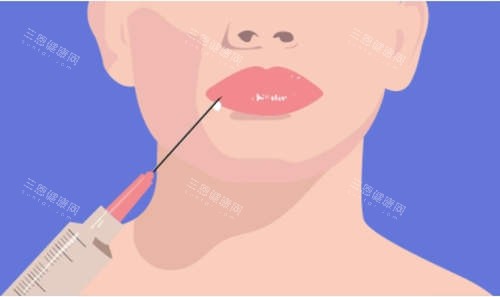 注射美容卡通圖