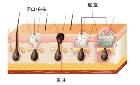 閉口黑頭白頭照片