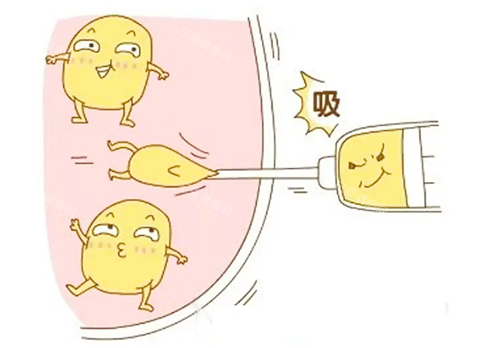 吸脂生動卡通圖