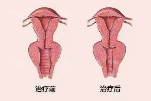 陰道緊縮卡通圖