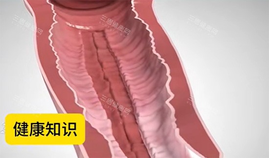 陰道緊縮針原理圖片