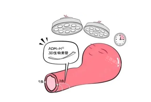 3d生物束帶縮陰