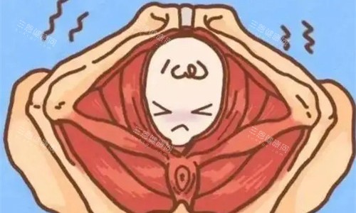 縮陰手術(shù)卡通圖