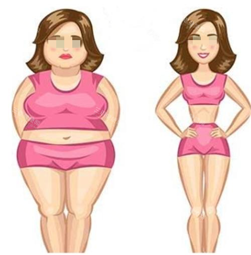 吸脂手術(shù)對(duì)比圖