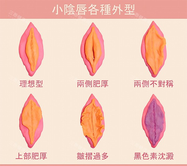 不同女性私密陰唇照片
