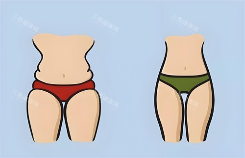 腿部吸脂手術(shù)前后對比正面動畫圖