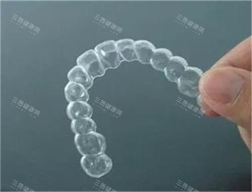 隱形牙齒矯正器示意圖