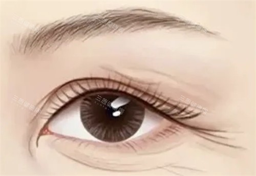 需要提眉切眉的情況