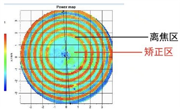 近視配鏡前檢查圖解