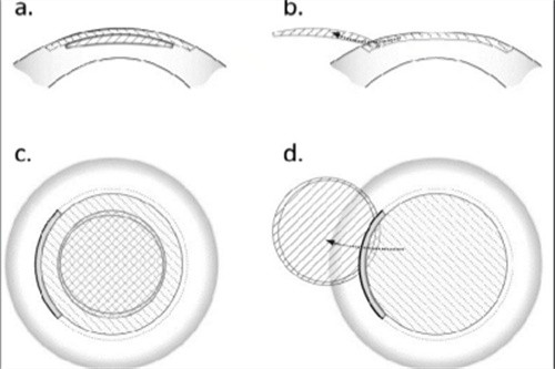 全飛秒過(guò)程