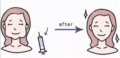 打針瘦臉卡通圖