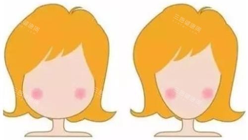 打針瘦臉明顯對比圖