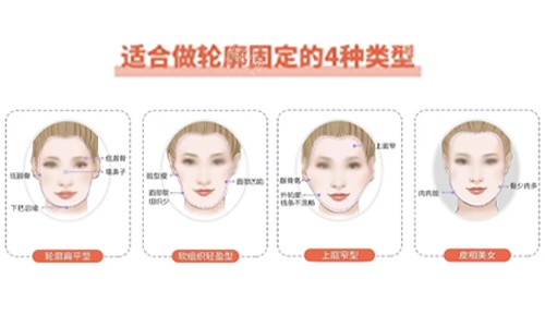 面部輪廓固定適合類型