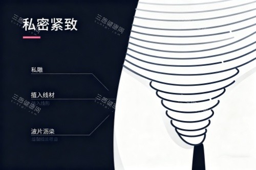 緊密緊縮卡通圖