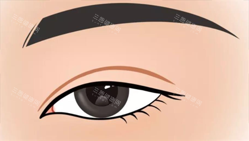 雙眼皮形態(tài)展示