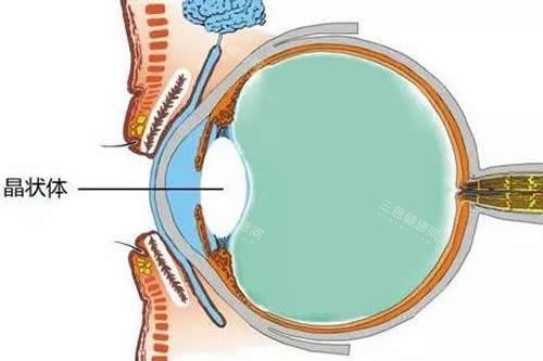 白內(nèi)障位置展示