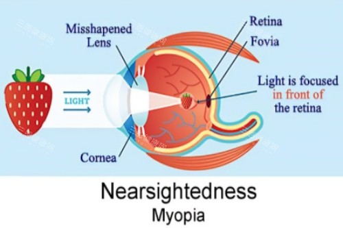 河北邢臺(tái)眼科醫(yī)院地址在哪里？泉北東大街399號(hào)+團(tuán)結(jié)東大街分院地址+交通方案+預(yù)約流程+門(mén)診時(shí)段