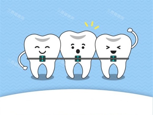 牙齒矯正動畫示意圖