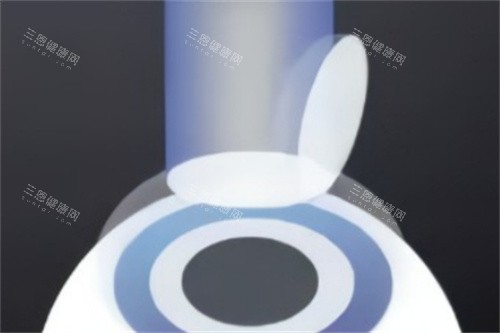 半飛秒準分子激光切削角膜