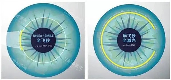 全飛秒半飛秒激光照片