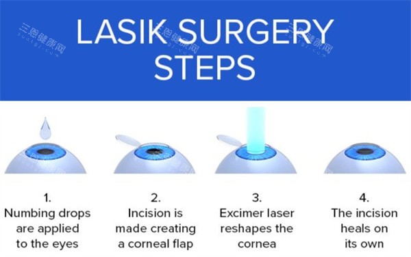 半飛秒激光治療眼睛