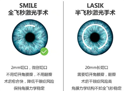 全飛秒與半飛秒手術(shù)對比圖