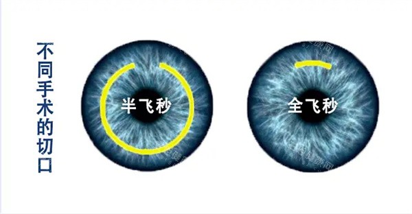 半飛秒和全飛秒?yún)^(qū)別