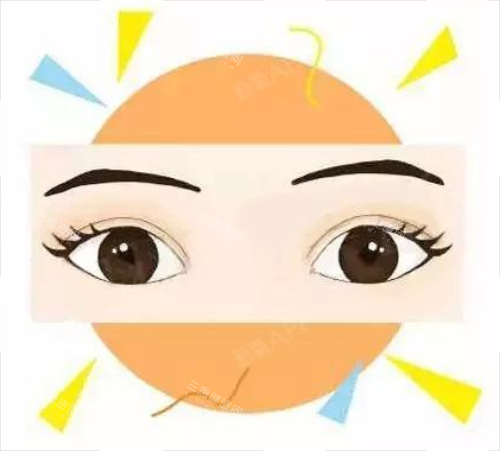 全切雙眼皮**圖