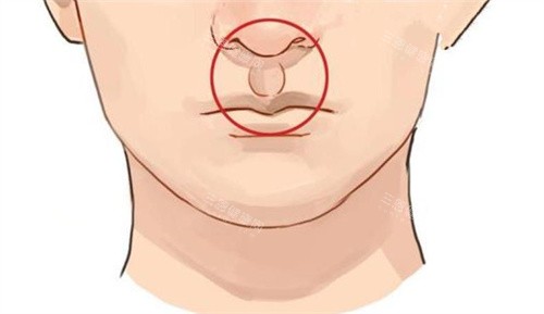 王曉健縮人中技術(shù)怎么樣？?jī)r(jià)格1.28w起+技術(shù)特色+就診流程全攻略