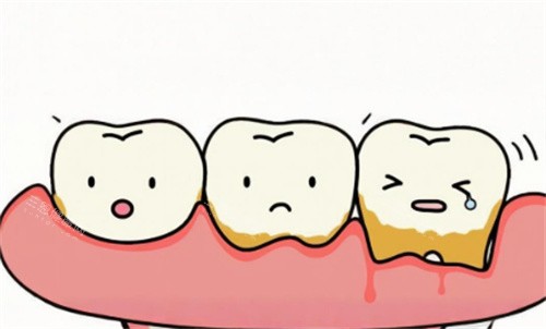 牙周炎動(dòng)畫圖