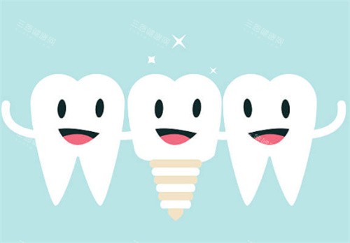 種植牙和健康牙齒圖