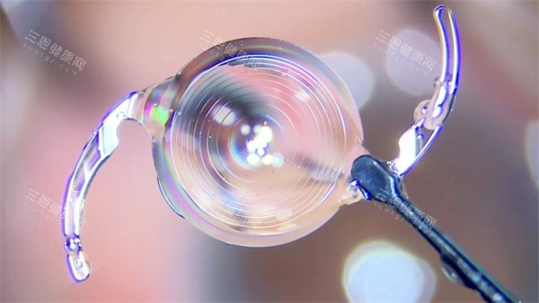 白內障晶體示意圖