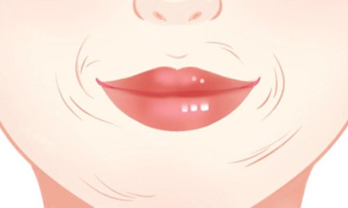 口周紋動畫圖