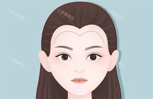 植發(fā)際線卡通